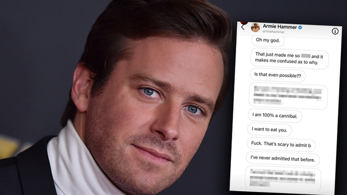 Armie Hammer