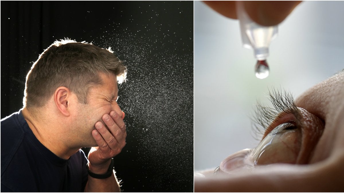 Allergier
