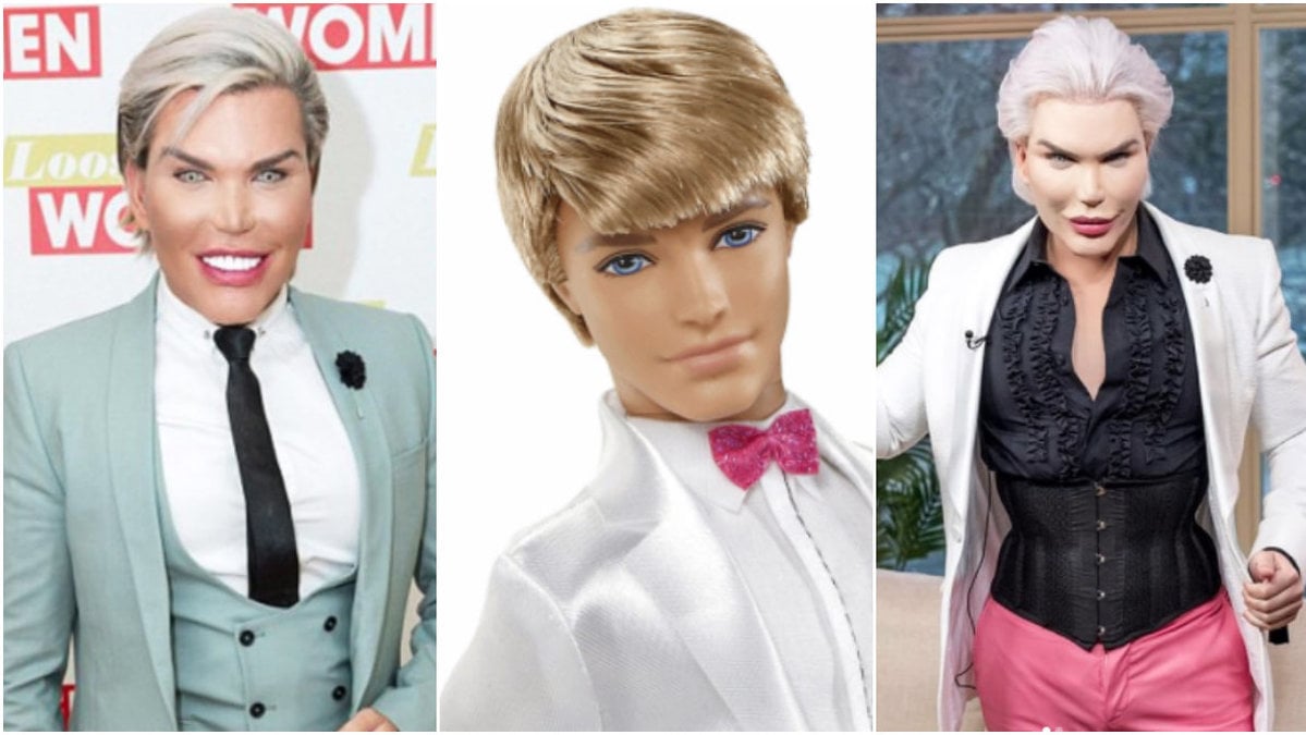 Rodrigo Alves färdigopererad