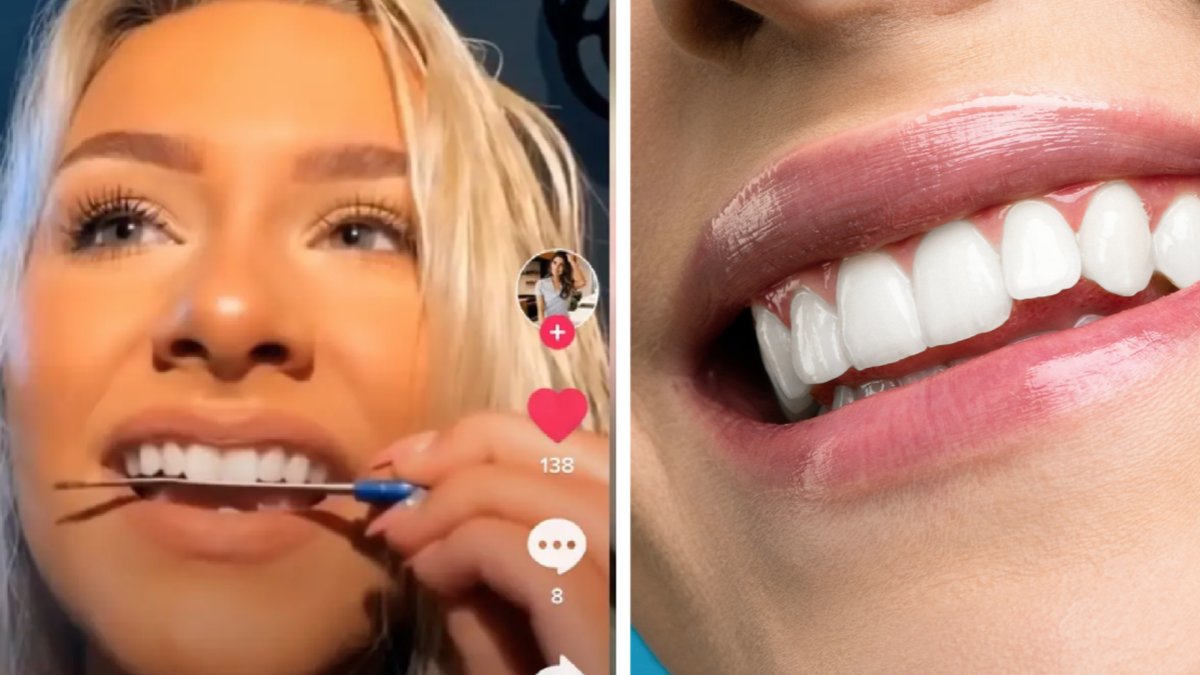 Nya TikTok-utmaning är en mardröm för alla tandläkare.