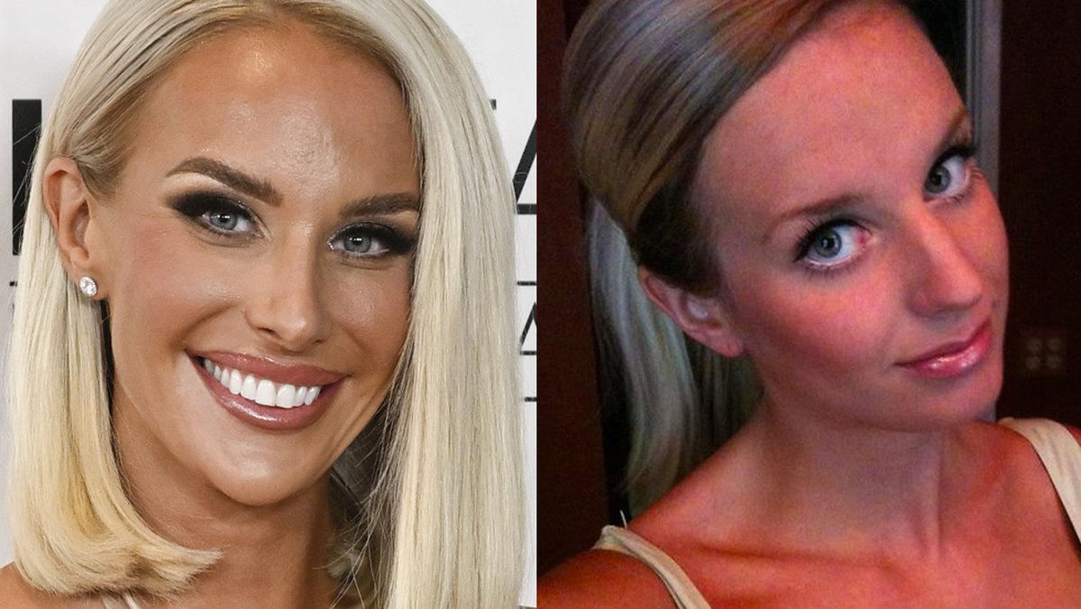 Julia Franzén har alltid varit öppen med sina skönhetsingrepp