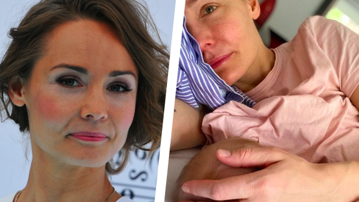 Carina-Berg-har-fatt-mjallvartor-over-hela-kroppen