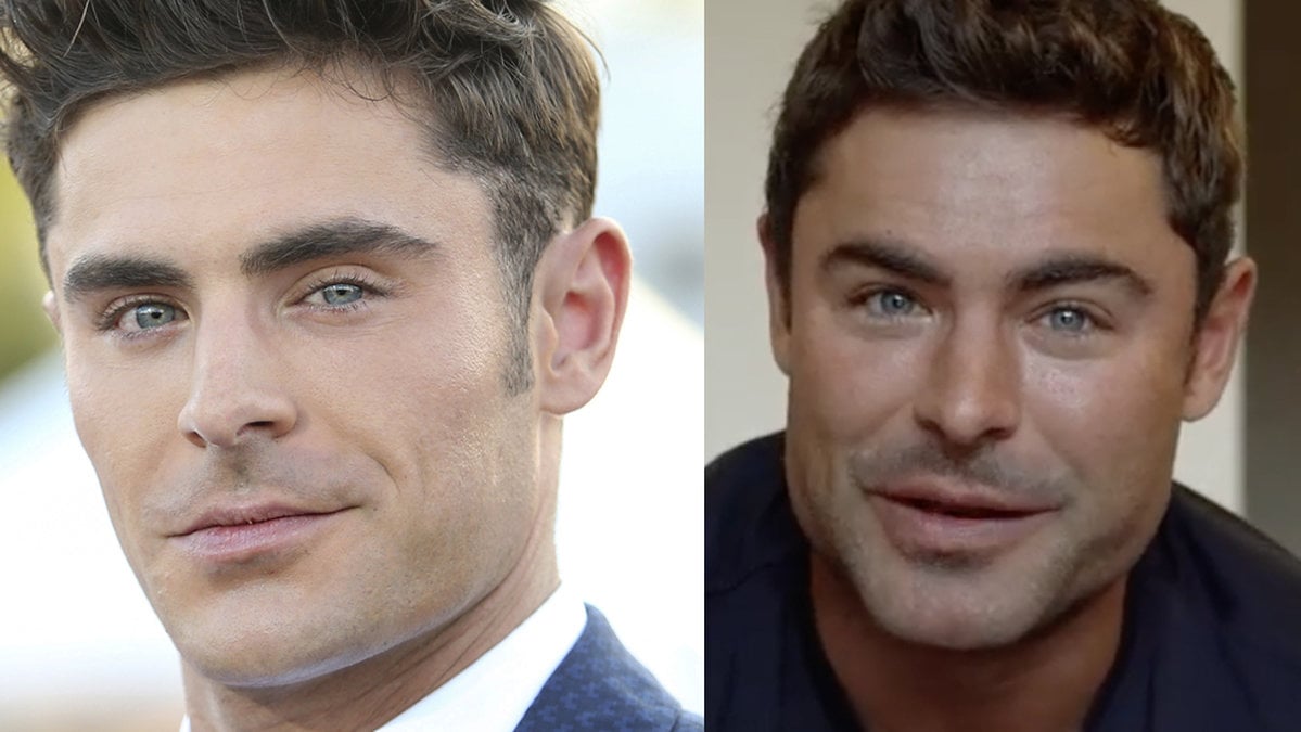 Zac Efron bemöter nu operationsryktena 