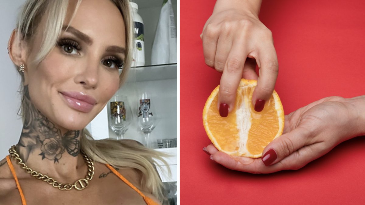 Fler kvinnor genomgår kosmetisk underlivskirurgi.