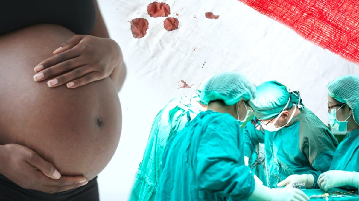 Vilka typer av förlossningsskador finns det, ovh vad är skillnaden på bristningsgrad 1, 2, 3 och 4. 