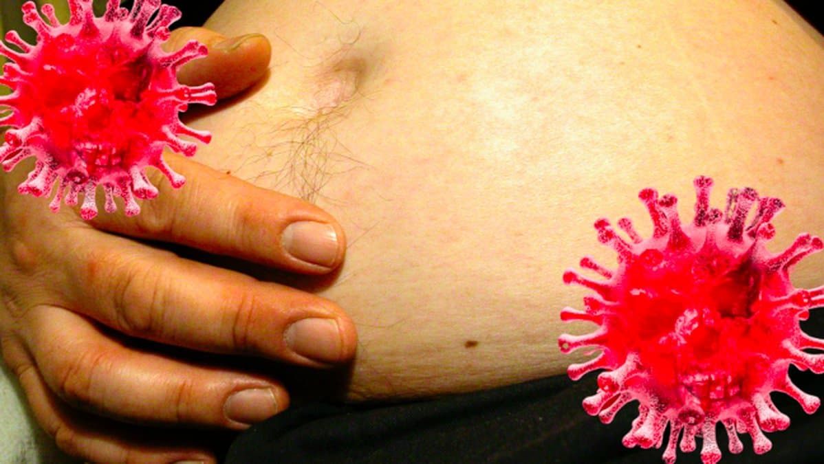 Sa-paverkar-ditt-BMI-risken-att-bli-allvarligt-sjuk-i-coronaviruset