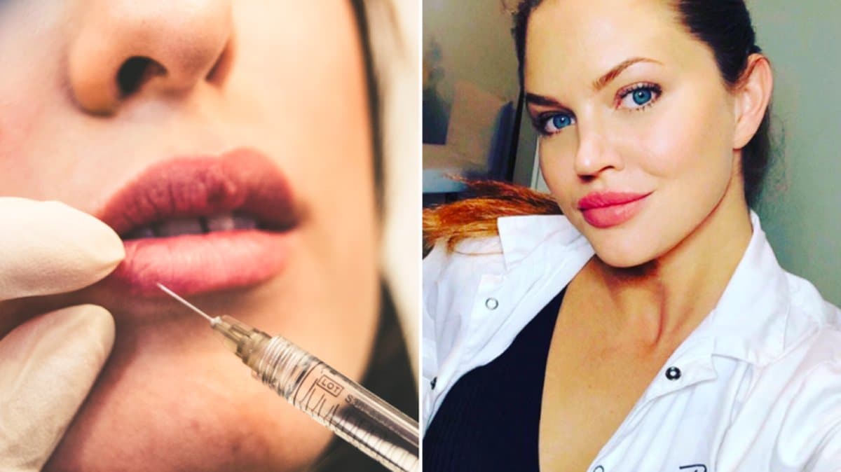 Nyheter24 intervjuade Amanda Siberg om myter och sanningar kring fillers.