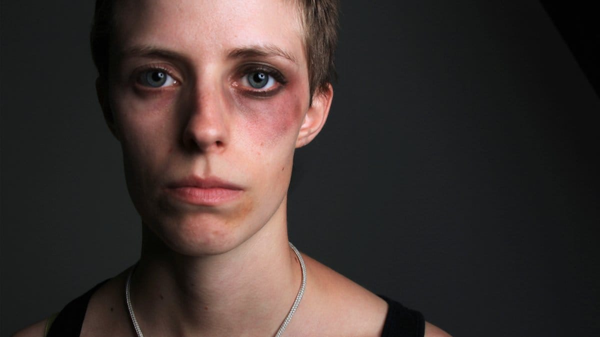 Slagen kvinna, sjukhus