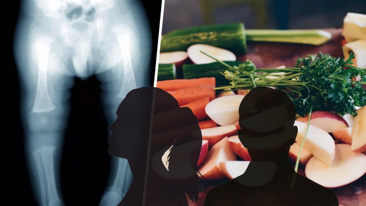 Parets dotter blev undernärd till följd av dieten.