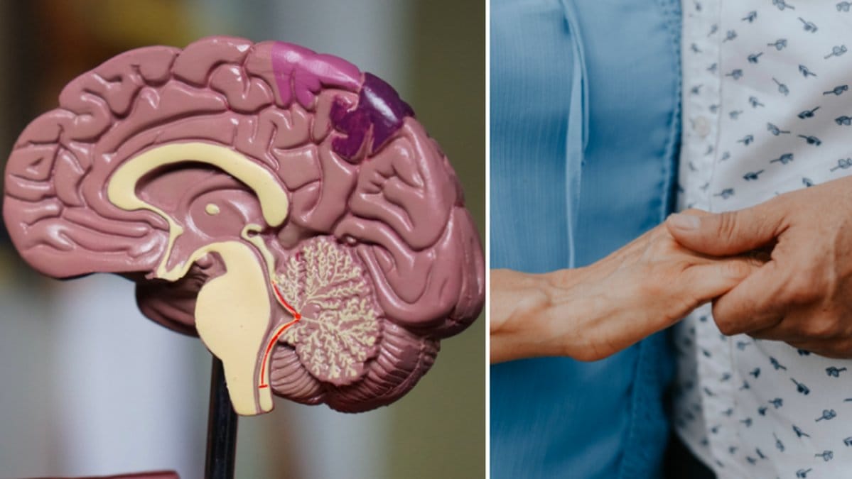 Vad är ALS och finns det ett botemedel?