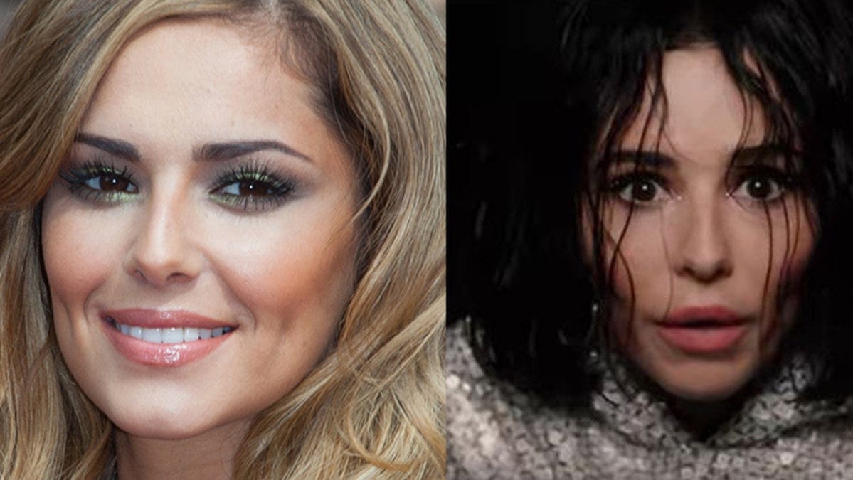 Cheryl Cole före och efter.