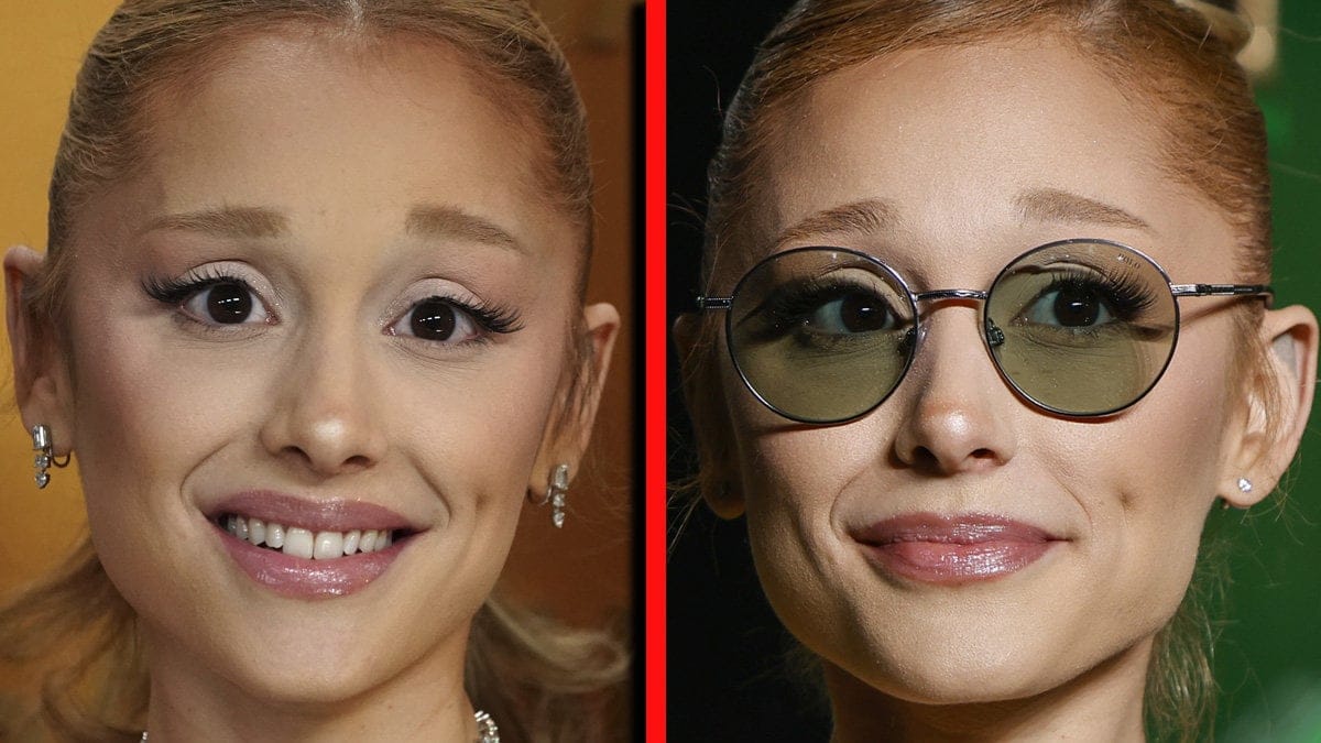Läkaren uttrycker sin oro över Ariana Grande 