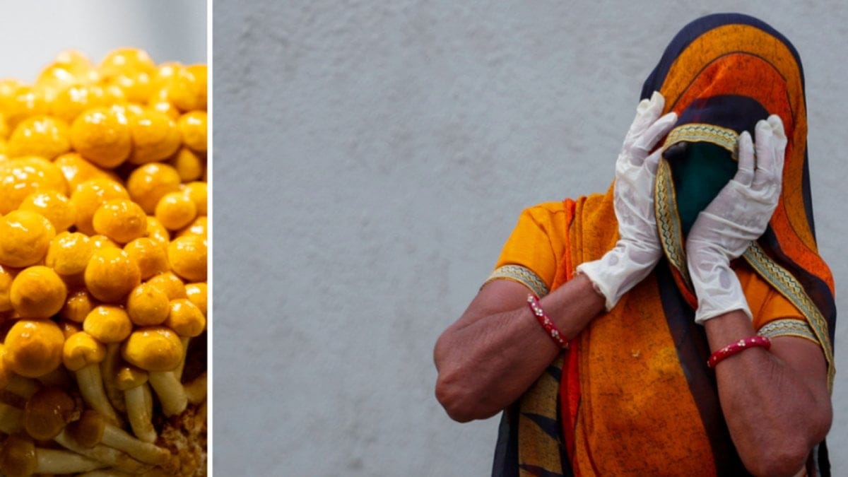 Allt fler drabbas av en svampinfektion efter corona i Indien.