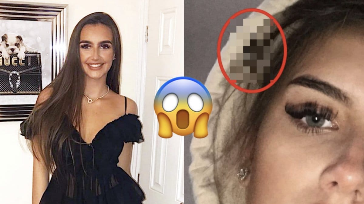 Oliva Nunns selfie blev viral. 