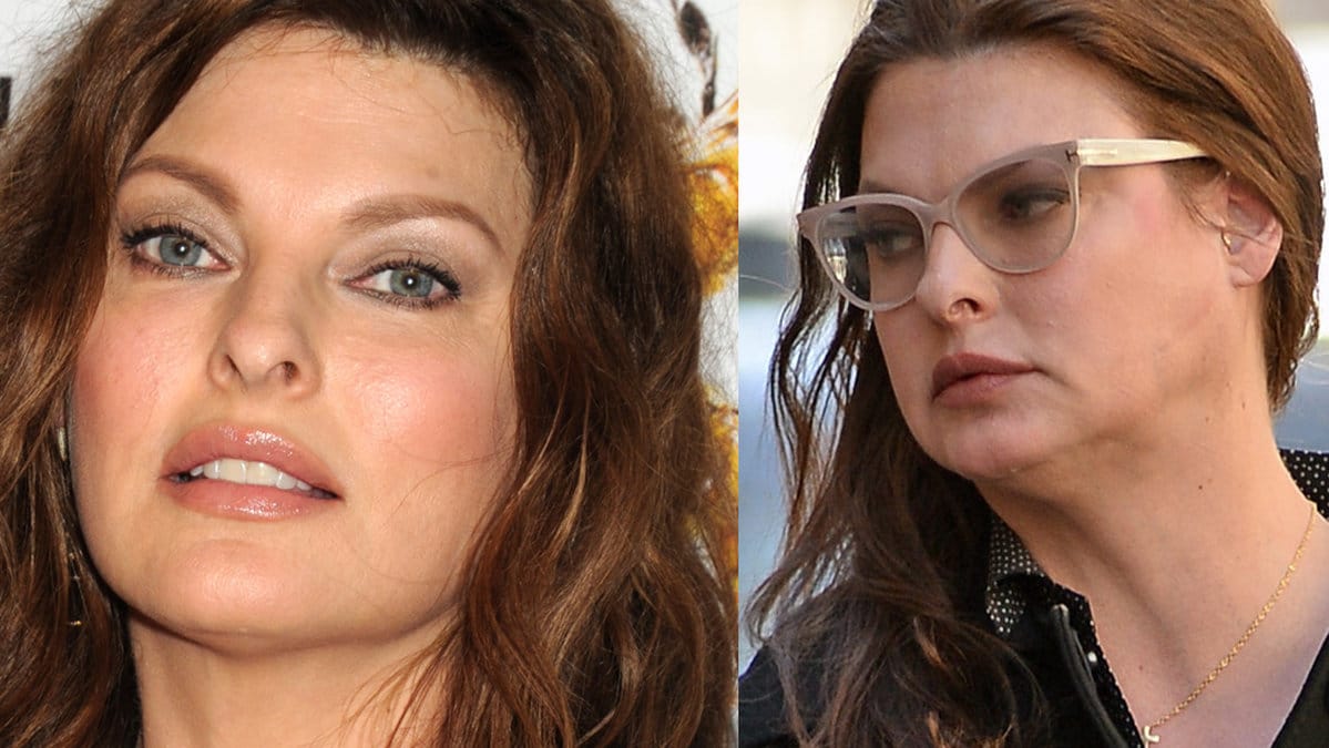 Supermodellen Linda Evangelista är vanställd för livet 