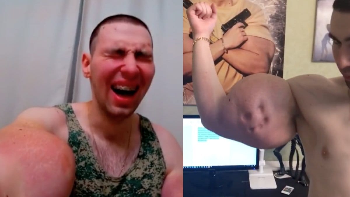 Rysk-bodybuilder-injicerar-armar-med-olja