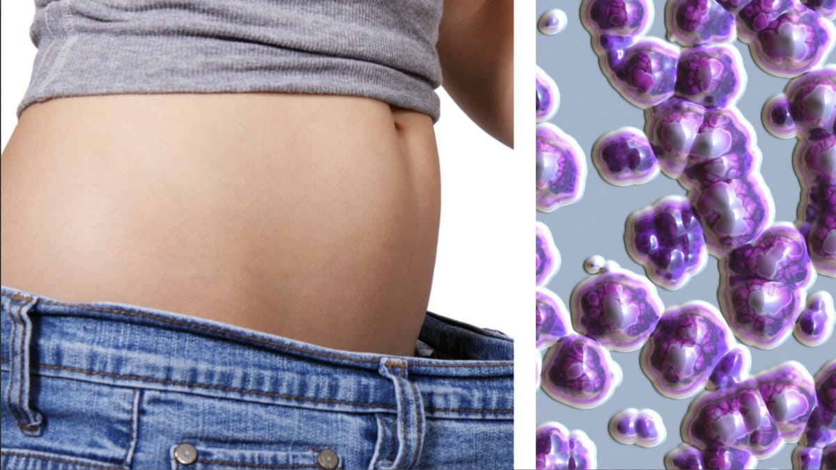 Bakterier-kan-skydda-mot-overvikt