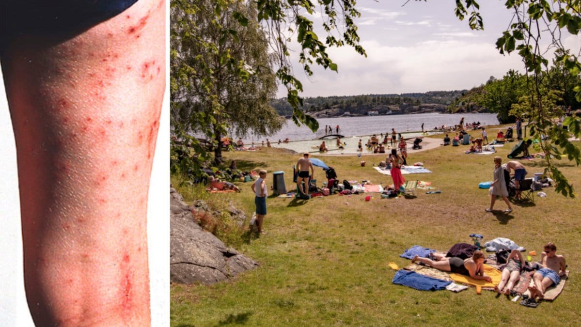 Utslag och genrebild på badplats.