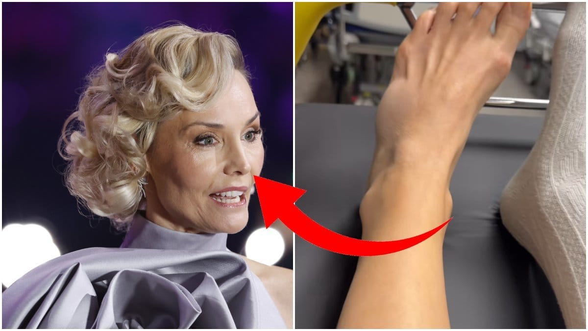 Carina Berg med skada.