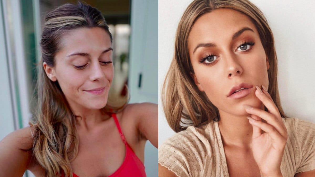 Bianca berättar om sitt ingrepp