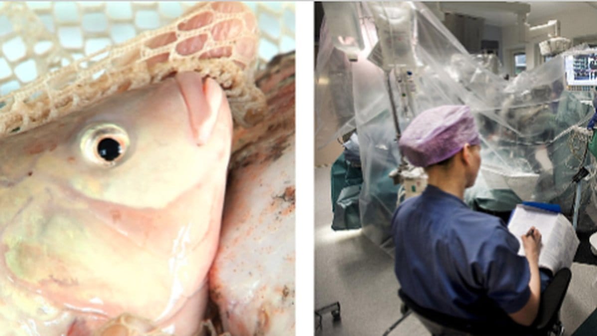 Transkvinna-far-vagina-av-fiskskinn