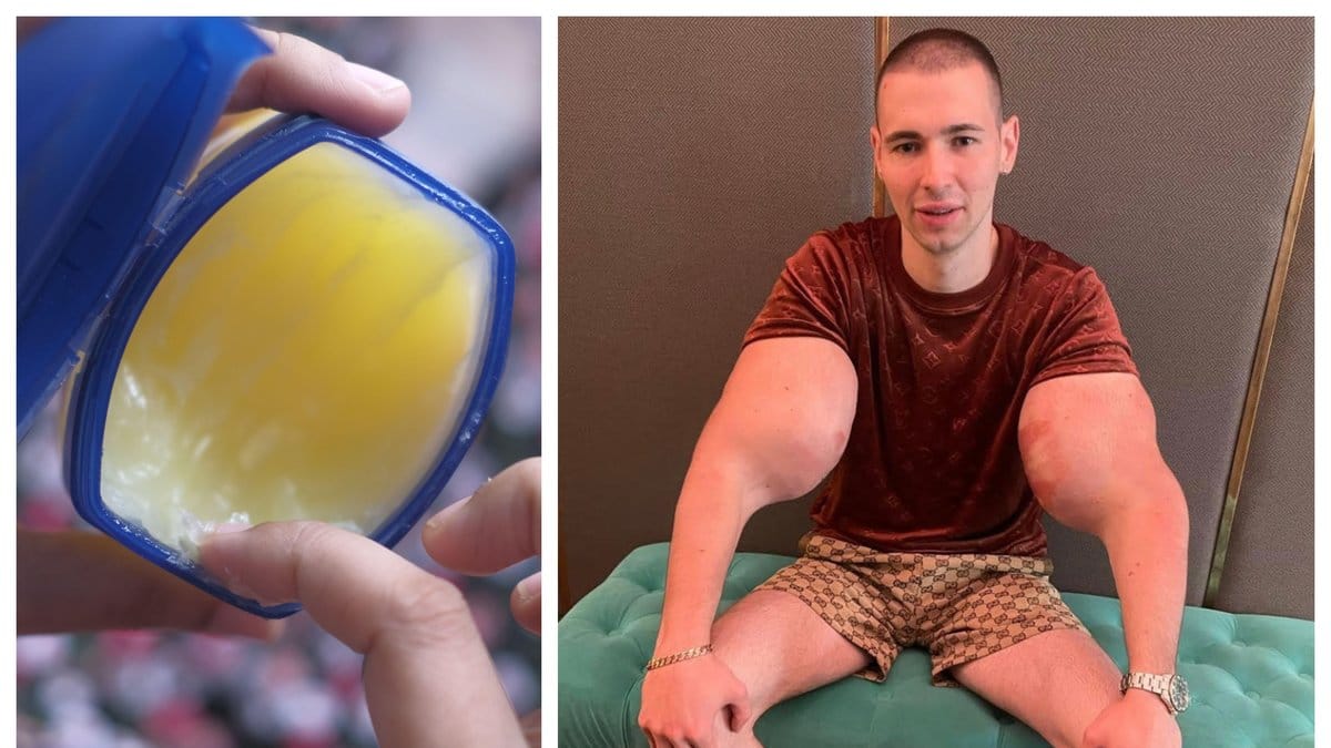 Kirill Tereshin, 25, har flera liter vaselin i sina armar.