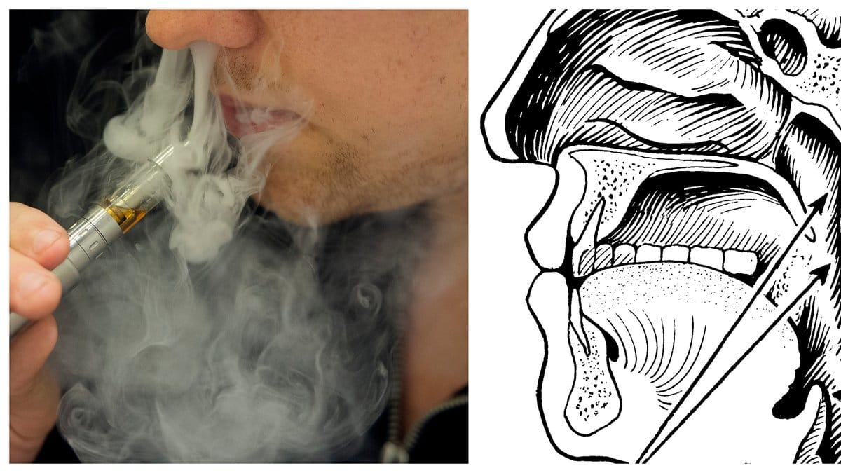 E-cigarett sprängdes i munnen. 