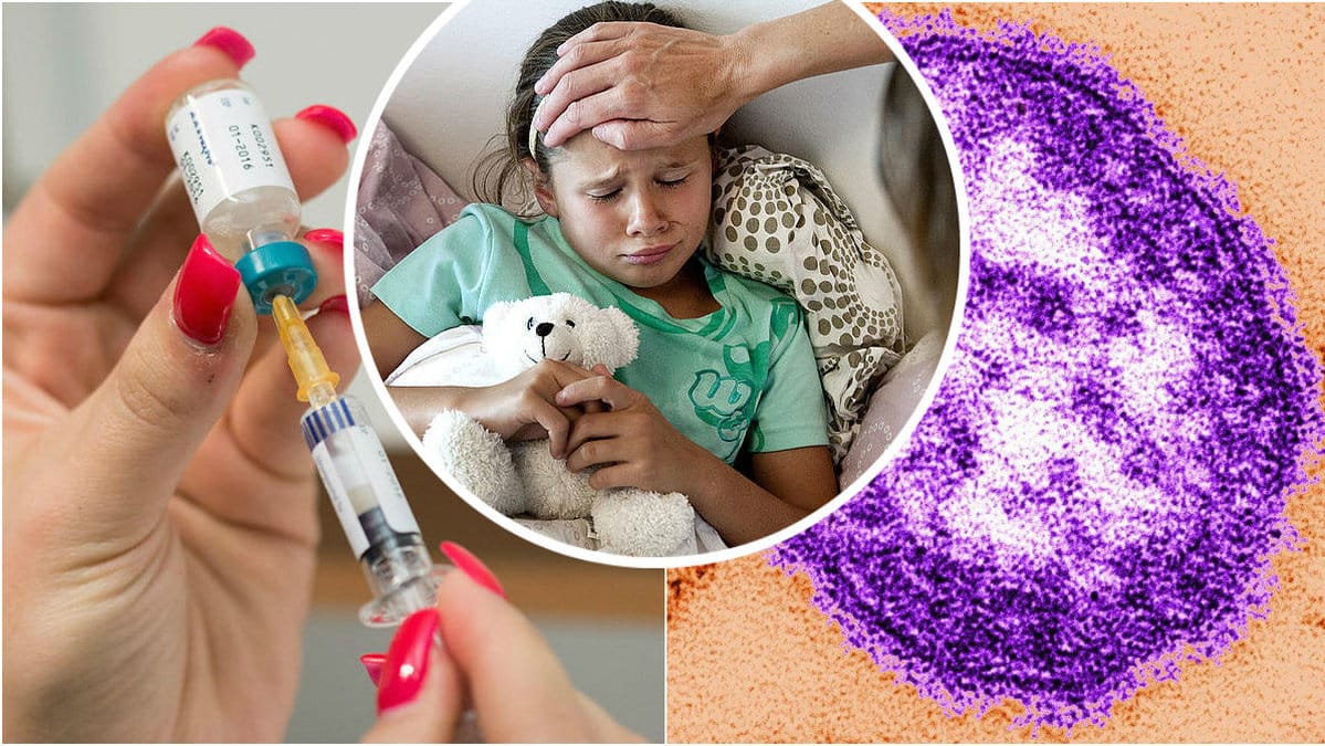 Mässlingen vaccin