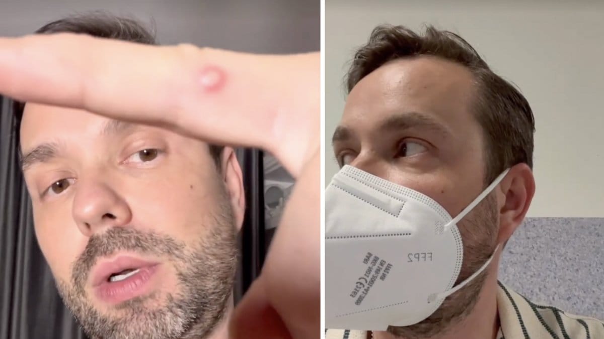 Maxim Sapozhnikov smittades med apkoppor.