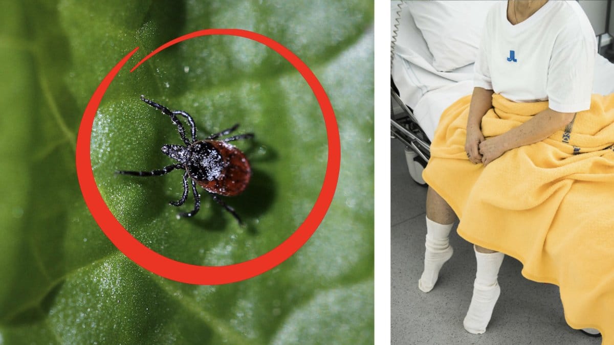 TBE-okar-trots-rekordmanga-vaccineringar