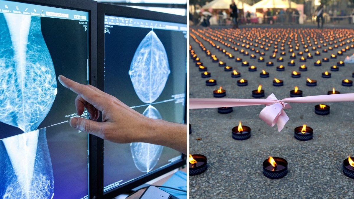 Bröstcancer och Rosa Bandet