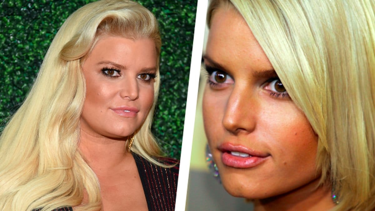 Jessica-Simpson-angrar-skonhetsoperationen