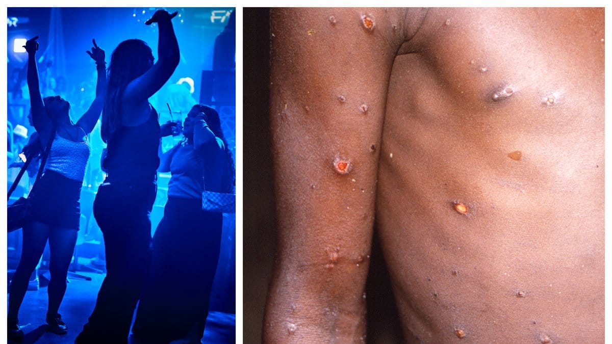 Belgien inför karantän för smittade med apkoppor.