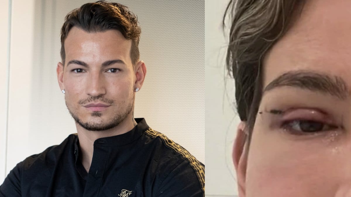 Marcelo skönhetsingrepp