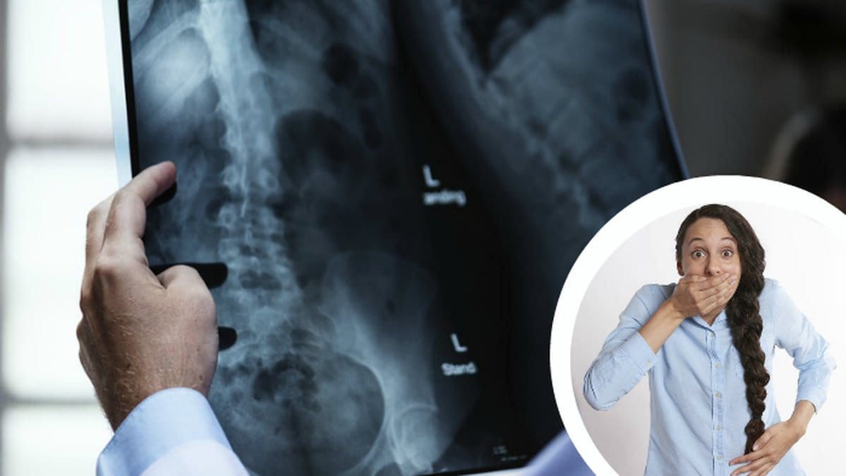 En person som håller en röntgenbild och en förvånad tjej.