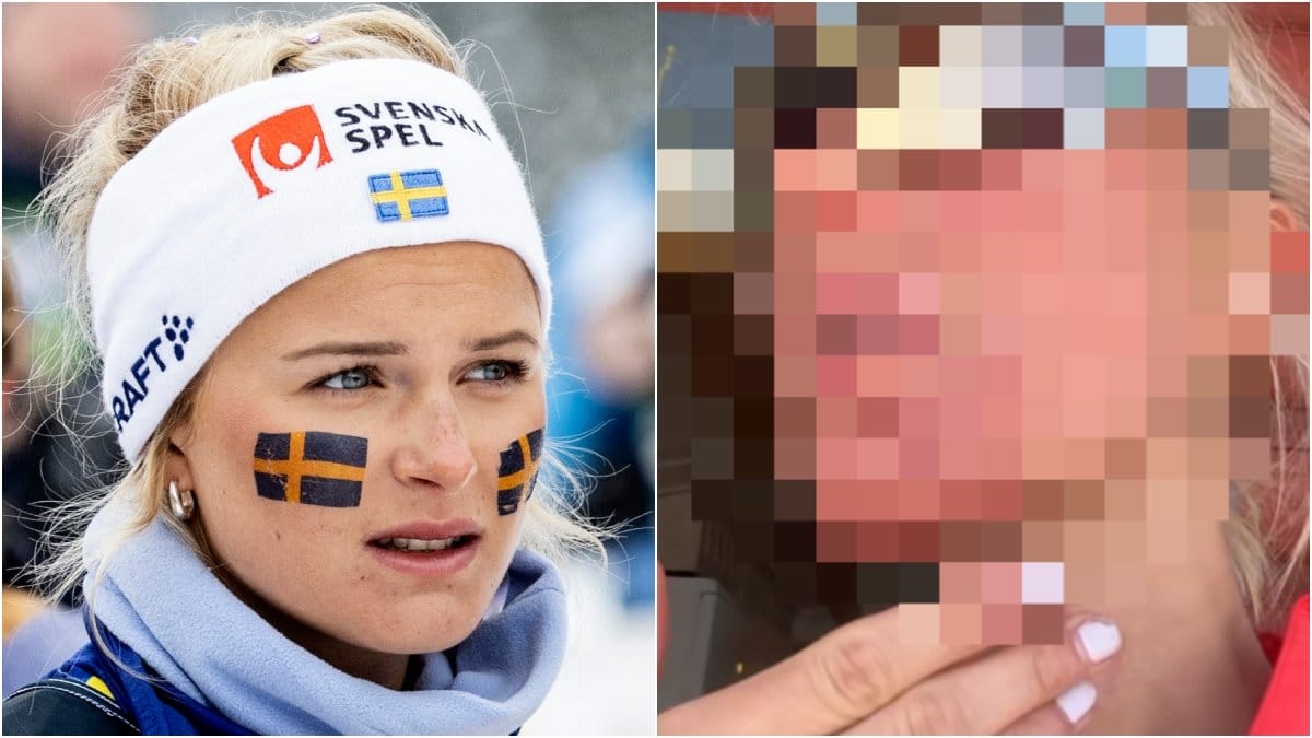 Under ett träningspass i Bruksvallarna slog sig Frida Karlsson blodig.