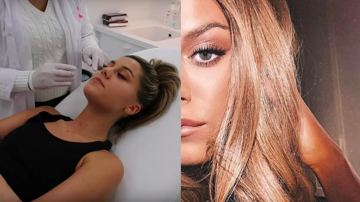 Bianca ingrosso skönhetsingrepp