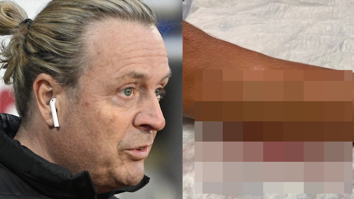 Runar Sögaards son Presley skjuten i benet