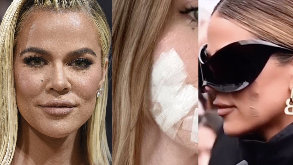 Khloé Kardashian har opererat bort sin tumör.