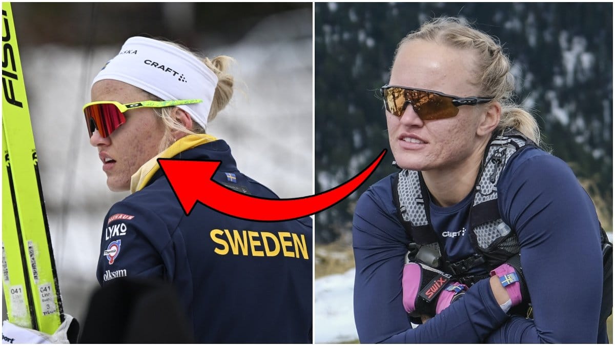 Linn Svahn fick lämna VM efter en hjärnskakning