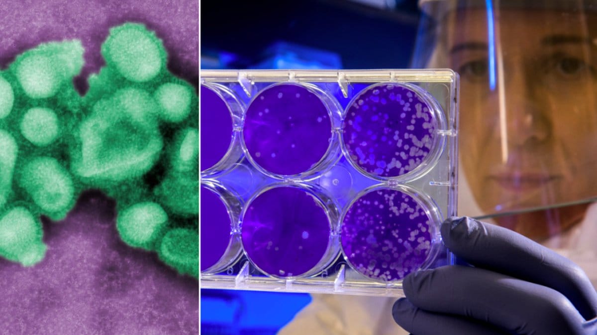 Den första varianten av spanska sjukan har hittats på ett museum i Berlin.