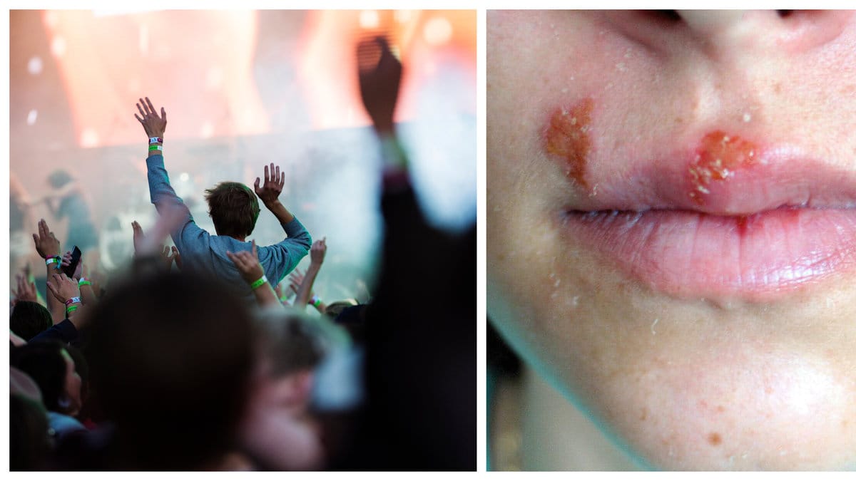Herpes-explosion under årets Coachella. 