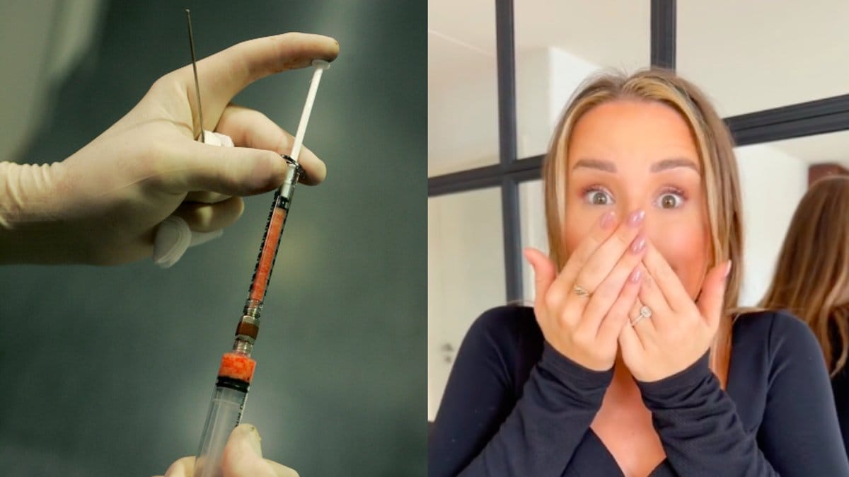 Alexandra Kissie Nilssons nya skönhetsoperation Bildkälla: Mats Andersson / TT och TikTok/AlexandraNilsson och