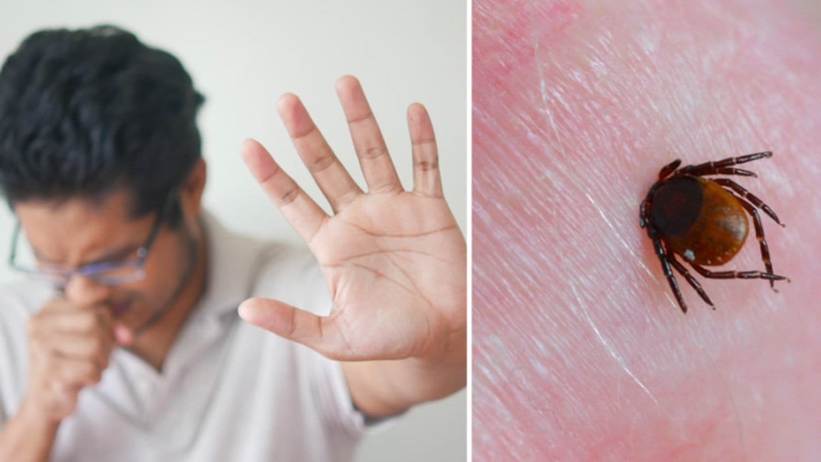 Fästingviruset kan orsaka symptom som feber och blödning från ögonen.