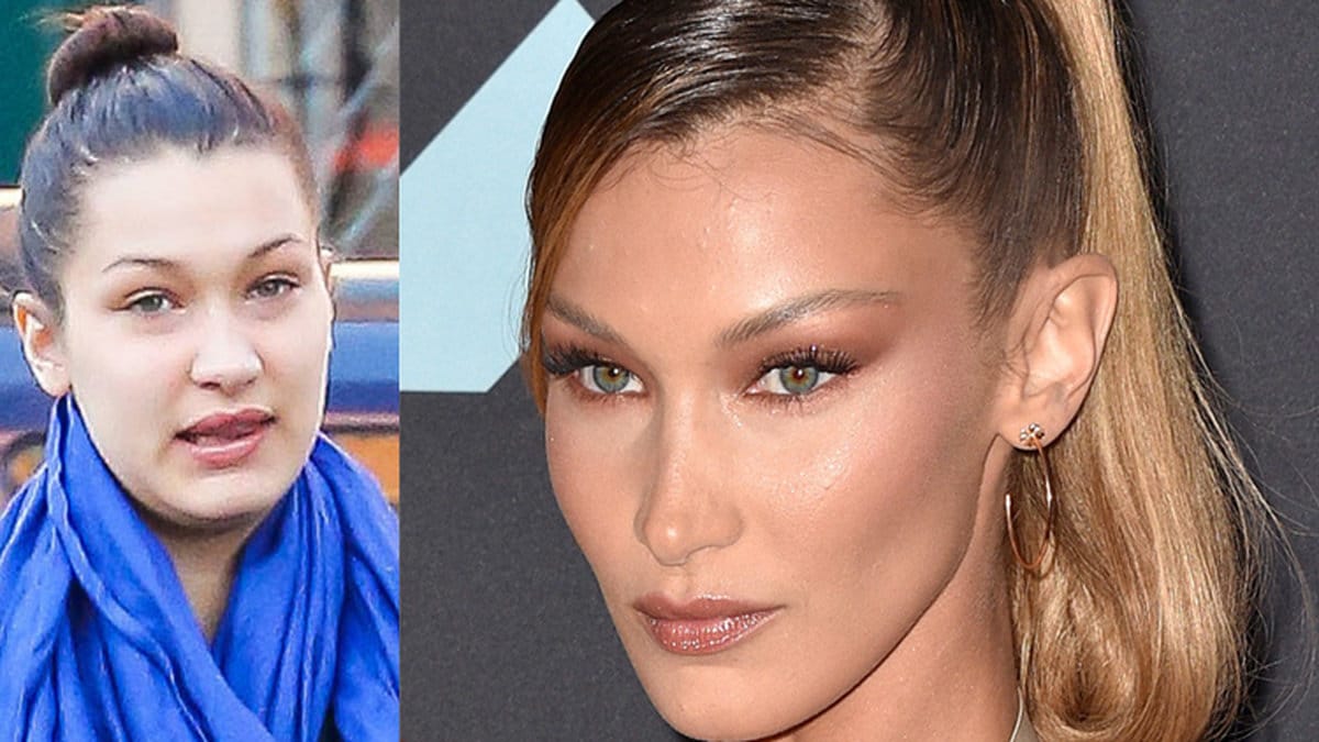 Bella Hadid före och efter operationerna