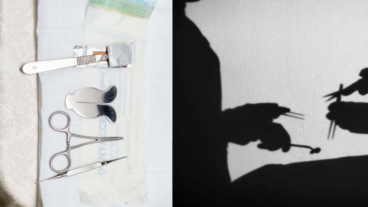 Illegal-omskarelse-i-Sverige