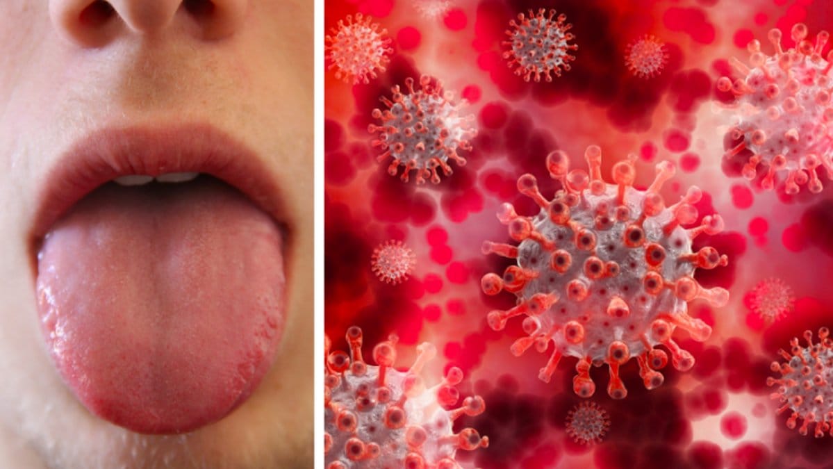 Ännu ett coronasymtom diskuteras nu bland forskare.