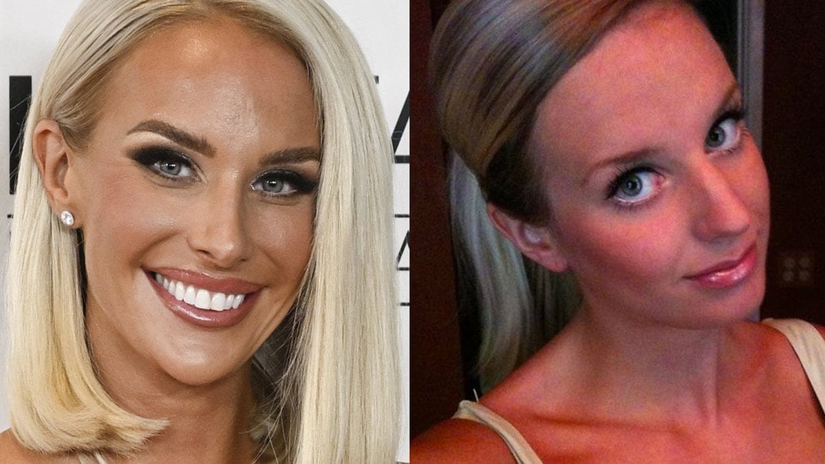 Julia Franzén har alltid varit öppen med sina skönhetsingrepp