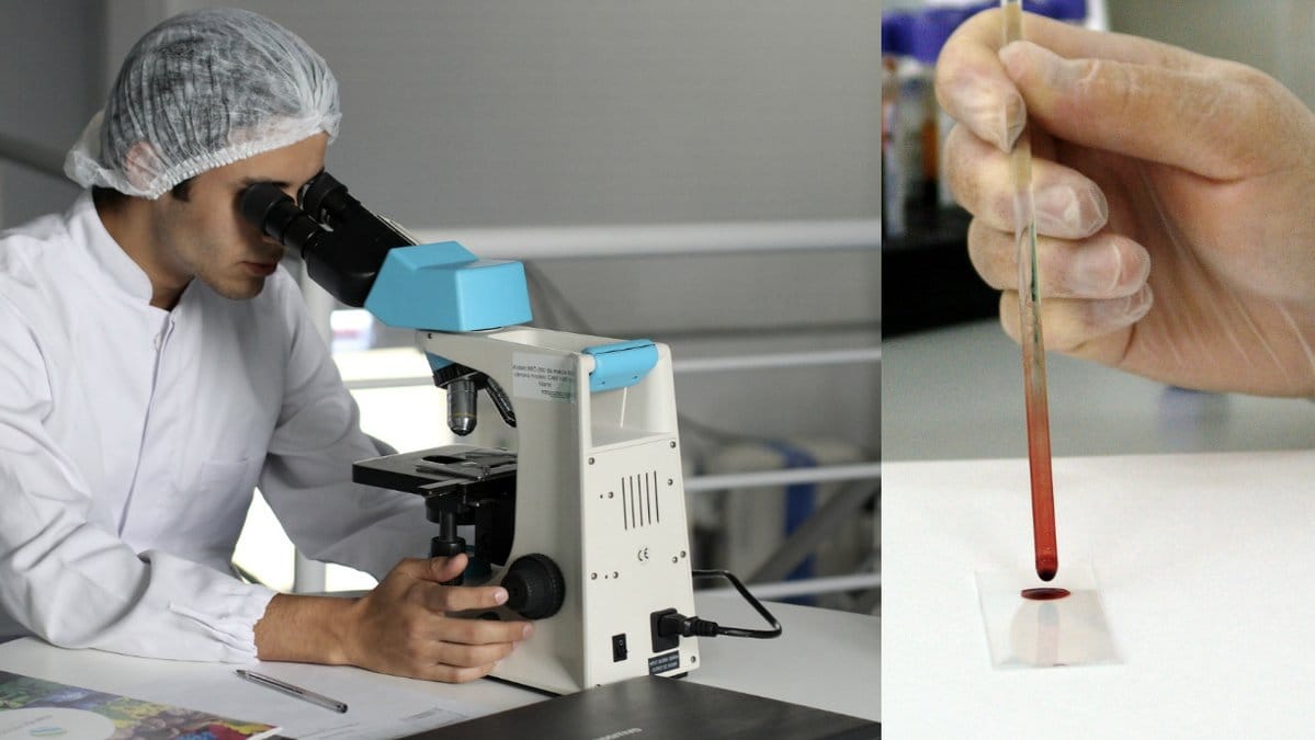 Forskare-har-lyckats-avlagsna-HIV-virus-fran-moss