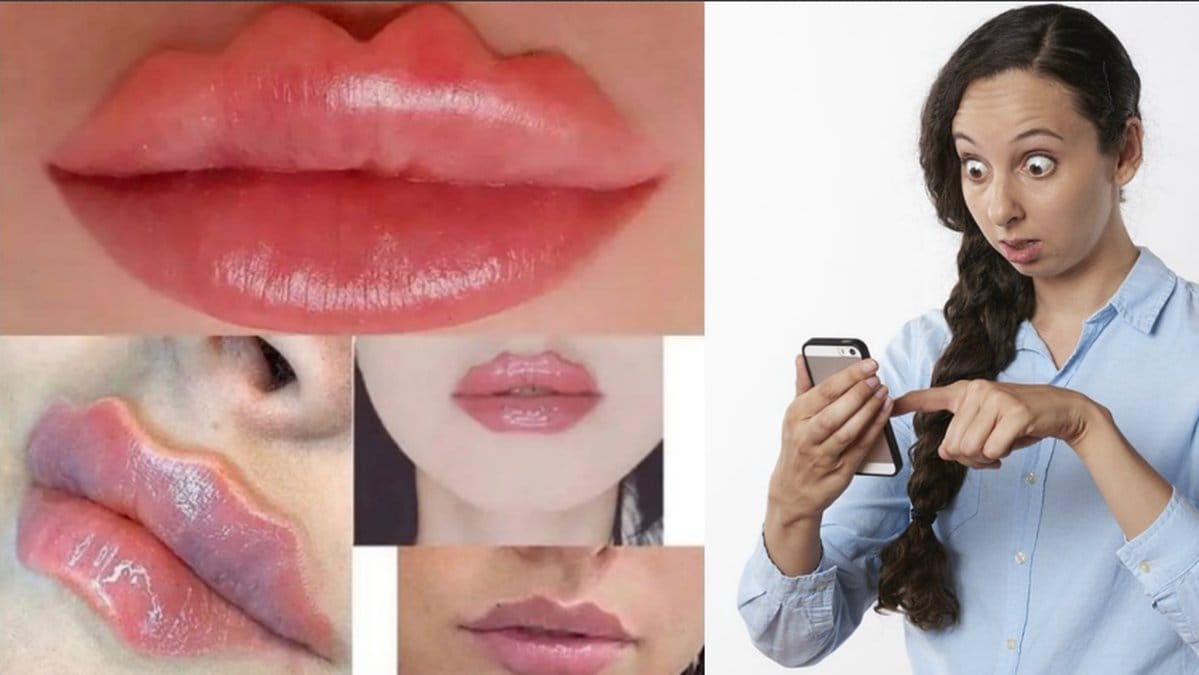 Vågiga läppar trendar på sociala medier.